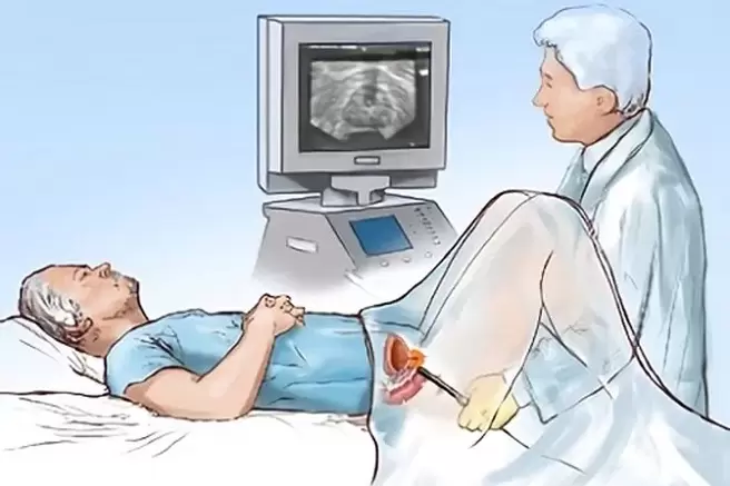 Diagnostic de la prostatite